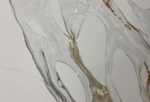 Mystery Gold